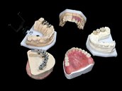 Dnes jsou zubní protézy o mnoho pohodlnjí a hygienitjí.