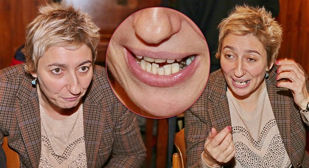 Simona Babáková má nepkné zuby.