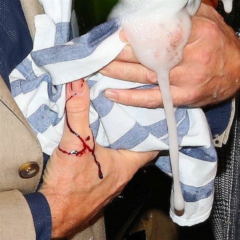 Krom� �ampa�sk�ho tekla i krev.