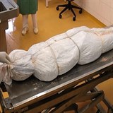 Tělo Moniky zabalené jako mumie během pitvy v Ostravě