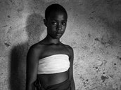 Fabiola (11) z Bafoussamu, drtili prsa dvakrát denn po dobu tí msíc....