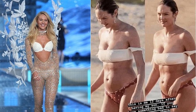 Zlatý hřeb body shamingu: Modelku Candice Swanepoel trollí pár dní po  porodu! - Expres.cz