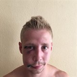 Snímky napadeného chlapce zveřejnil jeho švagr.
