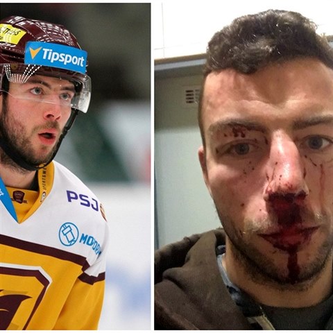 Jihlavský hokejista Michal Hlinka byl napaden skupinou nepřizpůsobivých...