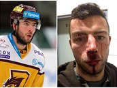 Jihlavský hokejista Michal Hlinka byl napaden skupinou nepizpsobivých...