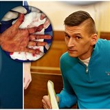Obhjkyn Radima ondry naznauje, e si tenistka Petra Kvitov mohla napaden...