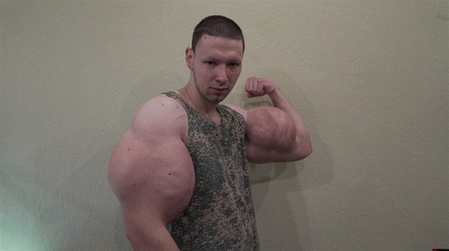 Krill Tereshin riskuje svj ivot kvli gigantickým bicepsm.