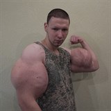 Krill Tereshin riskuje svj ivot kvli gigantickm bicepsm.