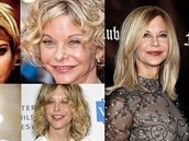 Slavná here�ka Meg Ryan podlehla botox�m.