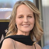 Hereka Helen Hunt a nepoveden zsah plastickch chirurg.