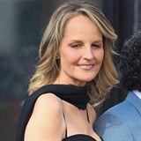 Plastick operace Helen Hunt bohuel moc nelichot.