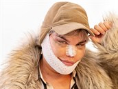 Rodrigo Alves obráí plastické operace a straí kolemjdoucí na letitích.