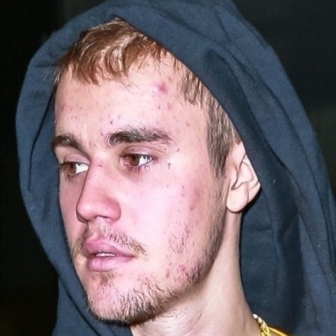 Justin Bieber, kdysi ikona dospvajcch dvek, dnes vypad jako ukzkov fek.