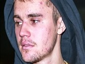 Justin Bieber, kdysi ikona dospívajících dívek, dnes vypadá jako ukázkový feák.