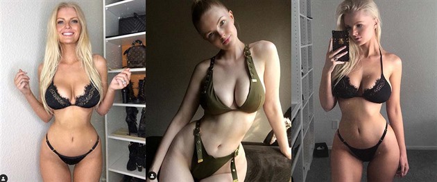 Sexy Instagram modelka zveejnila své rentgeny, aby dokázala, e je její tlo pravé
