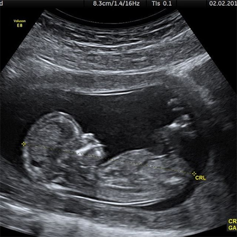 Bieber nejprve bez komente sdlel fotku ultrazvuku.