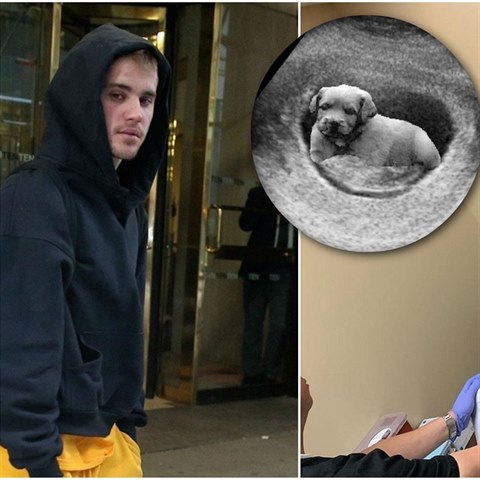 Bieber nap�lil fanou�ky s t�m, �e je Hailey t�hotn�. A te� skl�z� to, co zasel.
