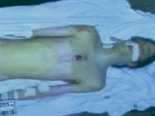 Objevila se fotka nahé mrtvoly Michaela Jacksona