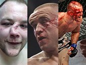 Fotospeciál: 20 dkaz, e zápasy MMA jsou ván hardcore