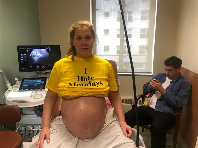 Amy Schumer jet ped porodem. Ani to nebylo zrovna super.