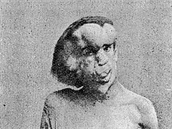 Sloní mu Joseph Merrick