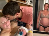 Amy Schumer se pochlubila, jak vypadá po porodu. Není to hezký pohled.