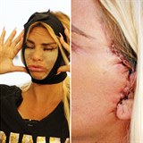 Britsk modelka Katie Price se vypravila do Instanbulu na plastiku. Cesta k...