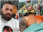 Karlos Vémola má za sebou operaci ramene.