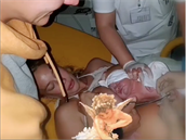 Aneta Krejíková zveejnila snímek z porodu svého syna Bena.