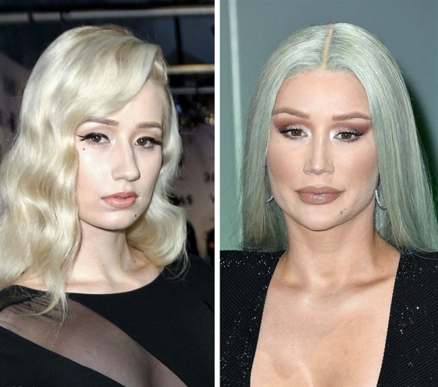 Iggy Azalea