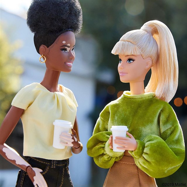Panenka Barbie s kon nemoc vitiligo