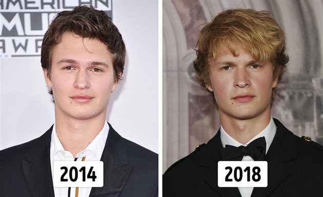 Ansel Elgort