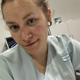 Elika pracuje v brnnsk nemocnici.