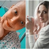 Anna Slováčková je po operaci.