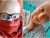 Anna Slováková je po operaci.