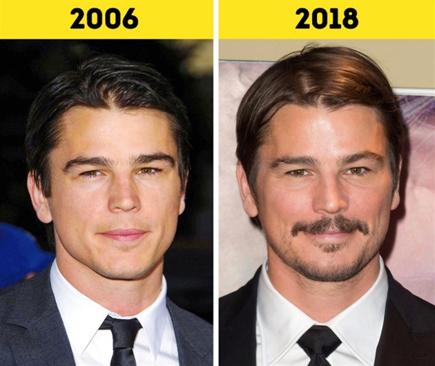 Josh Harnett