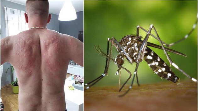 Komáři tygrovaní berou Evropu útokem. Bude se opakovat loňská chorvatská...