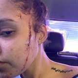 Neteř Michaela Jacksona (†50) Yasmine napadli před domem, stala se obětí...