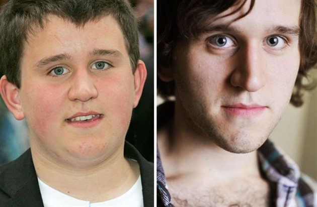 Harry Melling