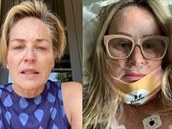 Sestra Sharon Stone onemocnla covidem-19 a bojuje o ivot.