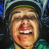 Andrea Sestini Hlavkov mla nehodu na kole. Cel zakrvcen musela vyhledat...