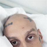 Separ podstoupil chemoterapii, která se na něj dost podepsala.