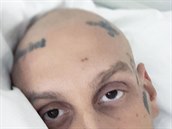 Separ podstoupil chemoterapii, která se na nj dost podepsala.