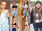Dívka na Instagramu popisuje svj boj s anorexii. Piznává, e byla na pokraji...