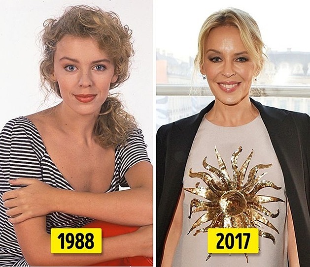 Kylie Minogue