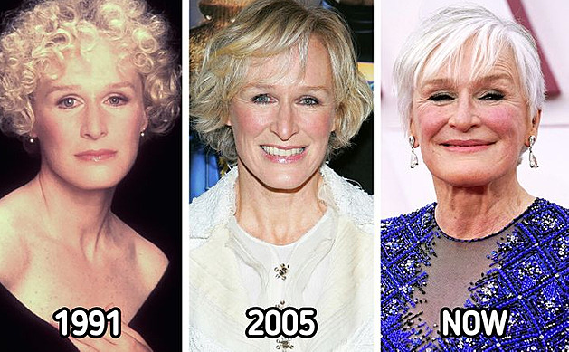 Glenn Close