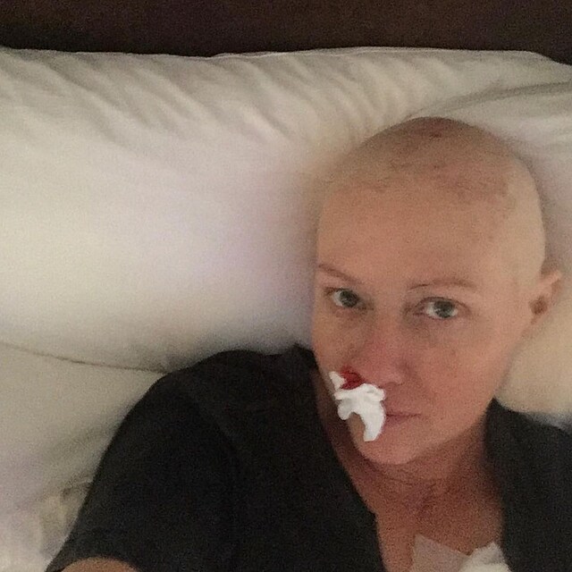 Shannen Doherty se podlila s fanouky o siln pbh ze svho boje z rakovinou.