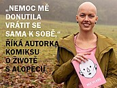 Tereza Drahoovská trpí alopecií také