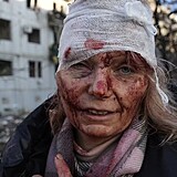 Zraněná žena před obytným komplexem u Charkova na Ukrajině.