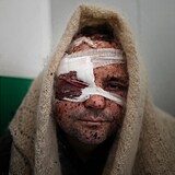 Mnoho Ukrajinců je vážně zraněno.